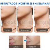 NUEVO y Exclusivo Masajeador Facial Massage